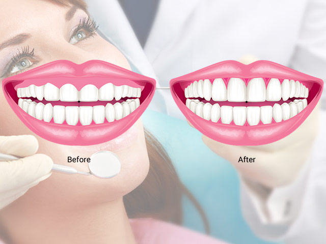 pembe estetik | antakya diş hekimleri